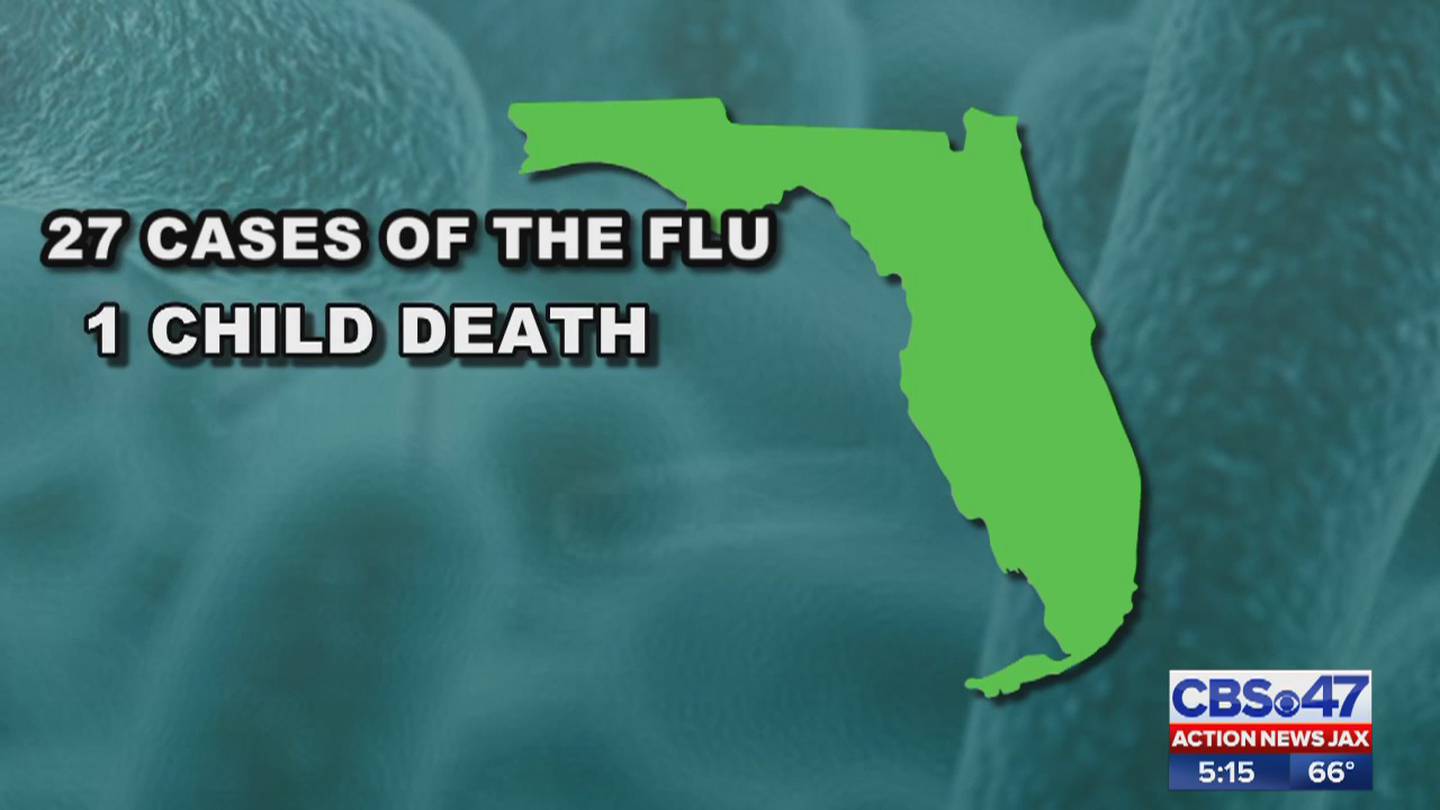 Flu activity is on the rise in Florida; outbreak in Jacksonville area