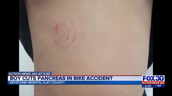 Clay County boy has bicycle fall that causes laceration on pancreas