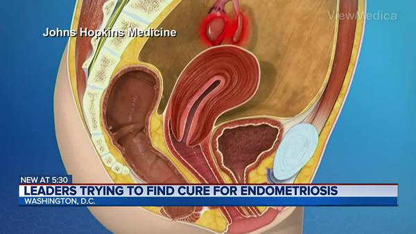 Congressional Endometriosis Caucus raises awareness about disorder affecting women