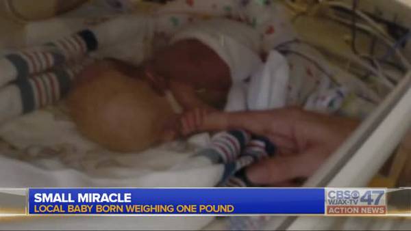 Miracle baby starts physical therapy 
