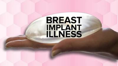 ‘It was very frightening:’ Clay County woman shares story about ‘breast implant illness’