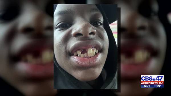 Video shows Palatka teacher knock out student's front tooth, police say