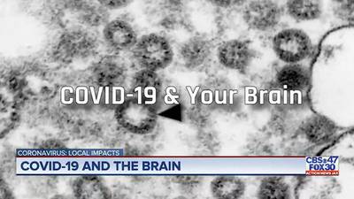 New study shows COVID-19 could hide in your brain and reactivate down the road
