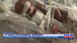 ‘We started crying;’ Jacksonville family sees daughter move limbs after fetal surgery