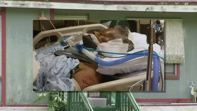 Putnam County dog attack leaves 86-year-old veteran hospitalized