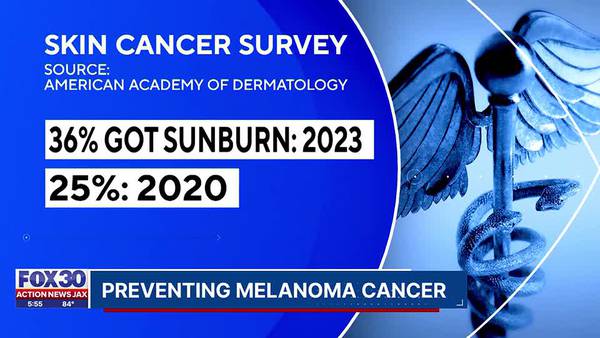 Preventing melanoma cancer