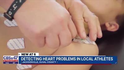 Cardiologists, local nonprofit encourage heart screenings for teens following Palatka teen’s death