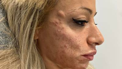 Photos: Pictures of woman who allegedly skipped on Botox and Filler Tab