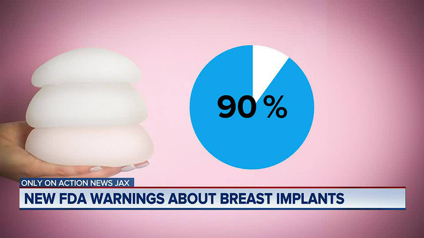 Woman Says Breast Implants Nearly Killed Her Now The Fda Is Strengthening Its Safety Guidelines
