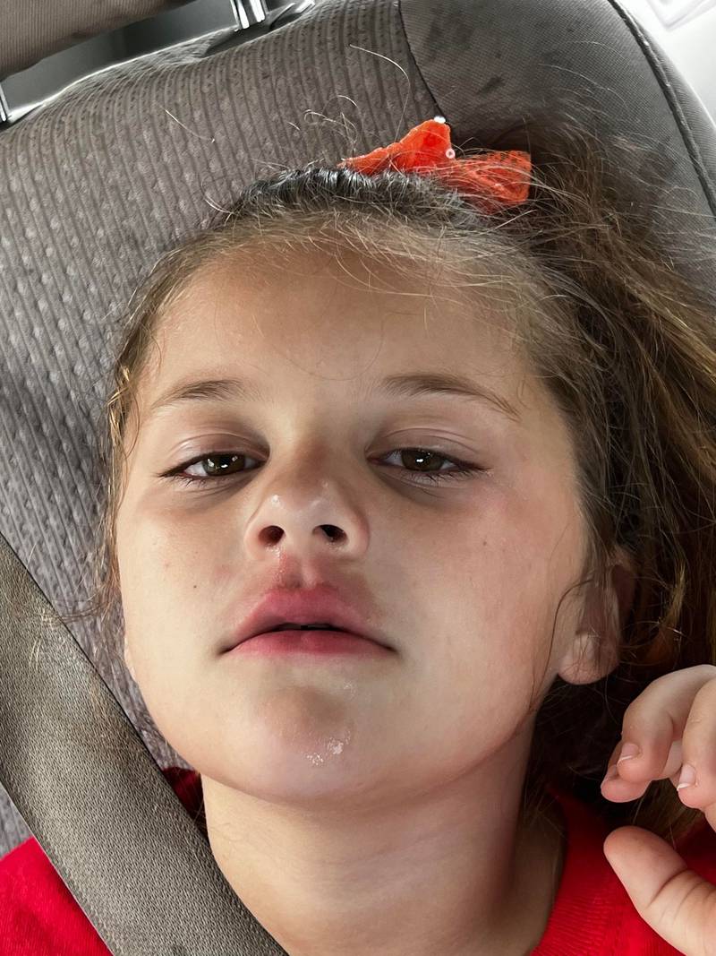 “I was so scared, I thought my kid was going to die,” said Lacy Goss, who rushed her daughter to the emergency room after she started breaking out in painful red splotches inside the Walmart.