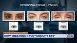 INVESTIGATES: ‘It’s changed my life:’ new non-surgical treatment helps patients with drooping eyelids