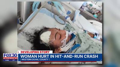 ‘Fighting for her life:’ JSO searching for driver who hit a teen and drove off in far west Duval