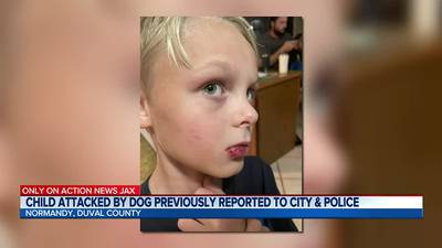 Jacksonville mother on edge after her 8-year-old son was attacked by stray dog