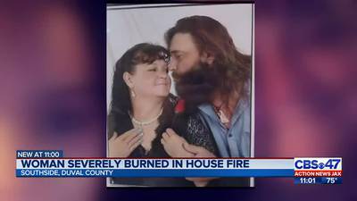 ‘Please help’: 911 calls describe intense Southside mobile home fire that left mother hospitalized 