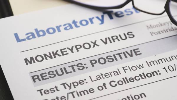 Monkeypox: Kentucky, North Carolina confirm first cases of virus