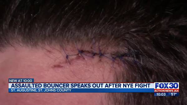 Assaulted St. Augustine bouncer speaks out after New Year’s Eve fight