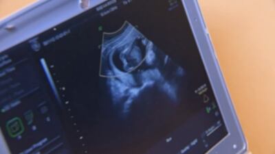 Florida House passes bill to ban abortions after 15 weeks of pregnancy