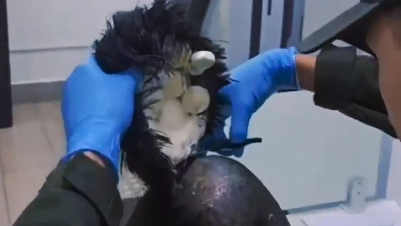 The man was preparing to fly from Colombia to Amsterdam.