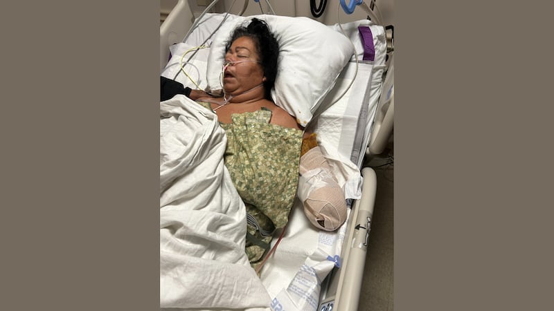 Jacksonville man alleges routine surgery led to mom’s amputation at HCA Florida Orange Park Hospital