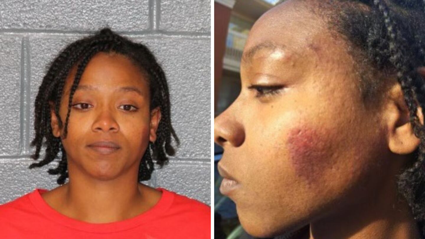 A mugshot shows bruising on the side of Christina Pierre's face after she was arrested by CMPD officers. The photo on the right, provided by Pierre's attorney, shows the bruising in more detail.