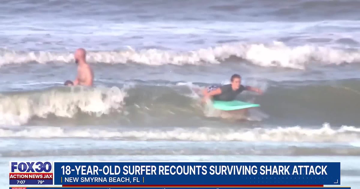 18-year-old Florida surfer recounts shark attack